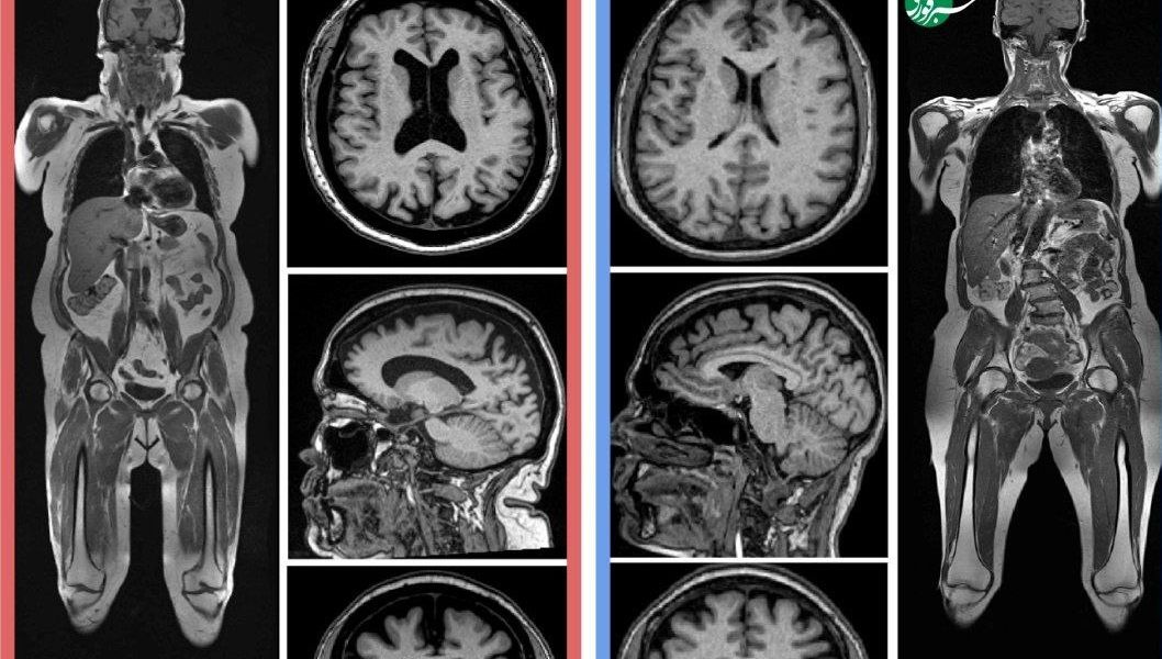 مغز جوان‌تر می‌خواهید؟ این توصیه‌ها را رعایت کنید 
