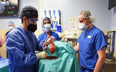 پیوند اندام خوک می‌تواند روزی از پیوند اندام انسانی پیشی بگیرد