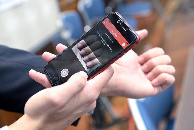 تشخیص کم‌خونی از روی عکس ناخن توسط یک اپلیکیشن هوش مصنوعی