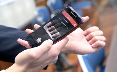 تشخیص کم‌خونی از روی عکس ناخن توسط یک اپلیکیشن هوش مصنوعی