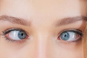 آیا لوچ کردن چشم‌ها از روی عمد واقعاً خطرناک است؟ 