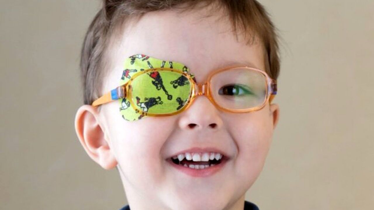 ضرورت درمان تنبلی چشم پیش از ۱۰ سالگی