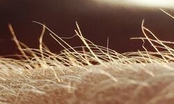 خارش احتمالا اندام حسی مخصوص به خود را دارد