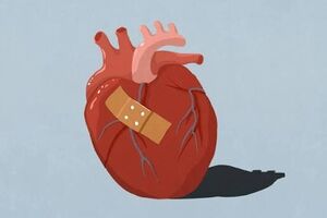 یک معیار جدید برای تشخیص سندرم قلب شکسته
