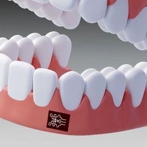 تشخیص التهاب لثه فقط با یک برچسب