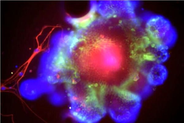 «الکل» سیستم ایمنی روده را خاموش می‌کند