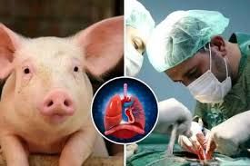 دانشمندان پس‌زدن پیوند اعضای خوک را مهار کردند 