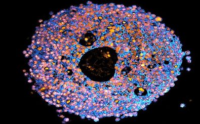 چاپ سه‌بُعدی جفت‌های کوچک جنینی در خدمت سلامت مادران