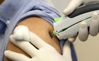 فناوری تزریق بدون سوزن؛ از دهه 40 میلادی تا به امروز/ ویدئو