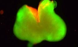 دستاوردی قابل توجه در ترمیم نخاع