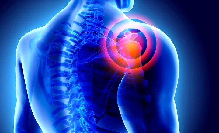 آیا سرما باعث درد شانه می‌شود؟/ شانه یخ‌زده چیست؟/ این درد درمانی دارد؟