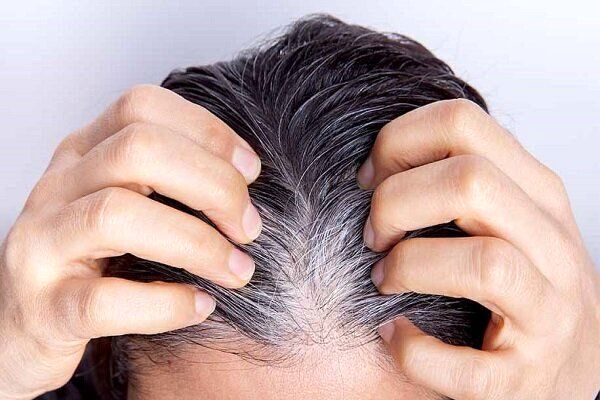 یافتهای جدید درباره سفید شدن مو
