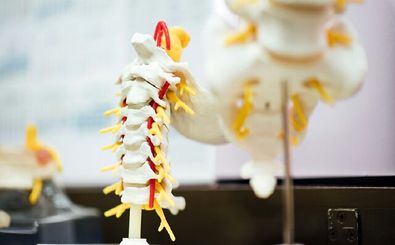 امکان ترمیم اعصاب نخاع با تزریق ژل نانویی