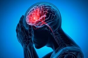 ارتباط میگرن با یک عارضه خطرناک در میانسالی