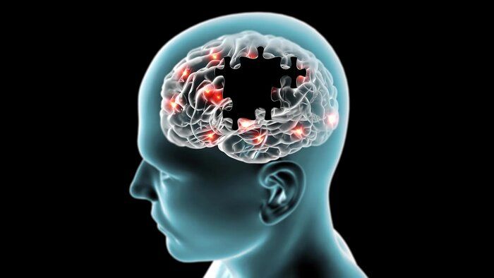 دستاوردهای امیدوارکننده ۲۰۲۵ برای مغز سالمندان 