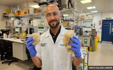 ترمیم دندان با خمیردندان ساخته شده از مو