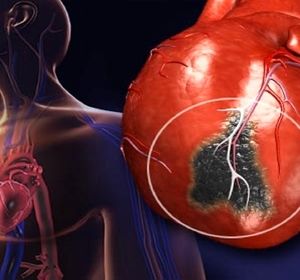 علت اصلی مرگ مردان مشخص شد