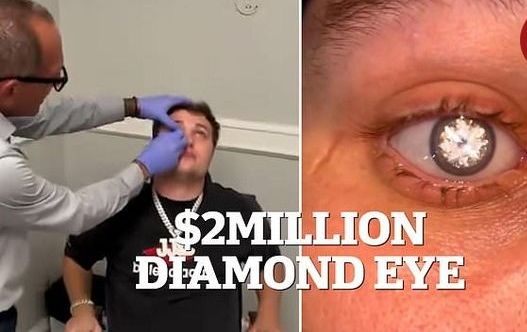 چشم مصنوعی با الماس ۲ قیراطی مردی که شبیه شرورهای جیمز باند است