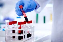 تشخیص خستگی مزمن با یک آزمایش خون پیشرفته