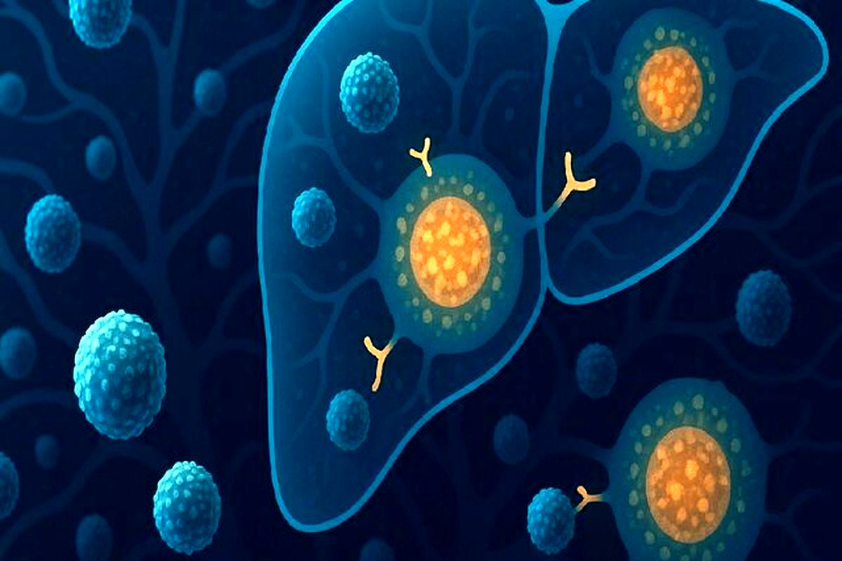 امید جدیدی برای درمان بیماری کبدی مرتبط با الکل
