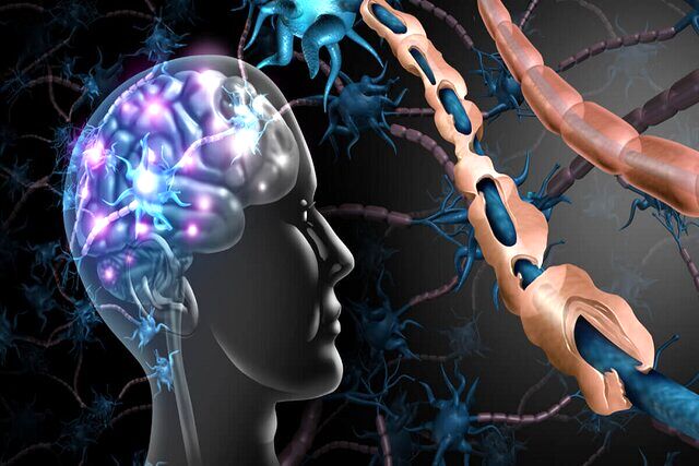 تشخیص سریع‌تر بیماری MS با کمک هوش مصنوعی