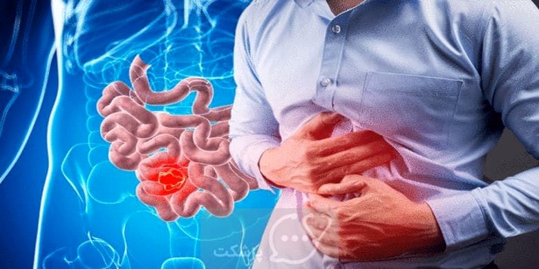 بهترین رژیم برای کاهش علائم التهاب روده چیست؟