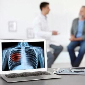 پرتودرمانی، جایگزینی قوی برای جراحی در سرطان ریه 