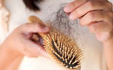 اختراع جالب برای کاهش ۹۲ درصدی ریزش مو 
