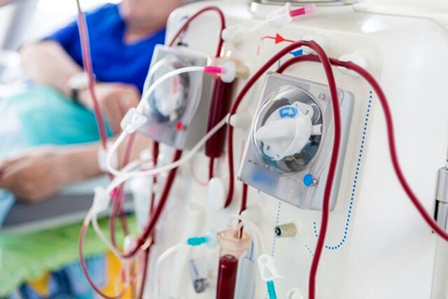 تشکیل کنسرسیومی برای تامین تجهیزات همودیالیز مراکز درمانی