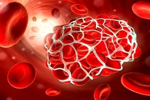 آیا بیماری هموفیلی قابل درمان است؟