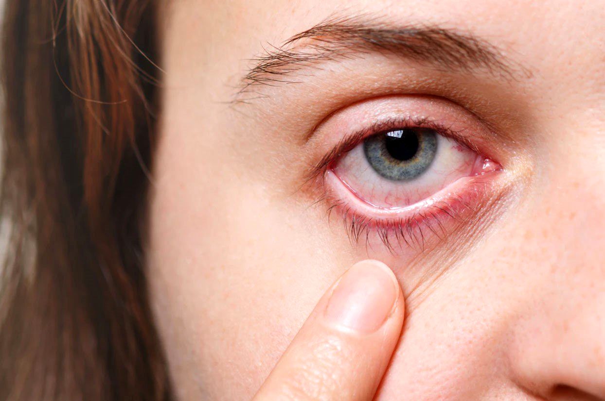 بلاهایی که آلودگی هوا بر سر چشم‌ها می‌آورد 