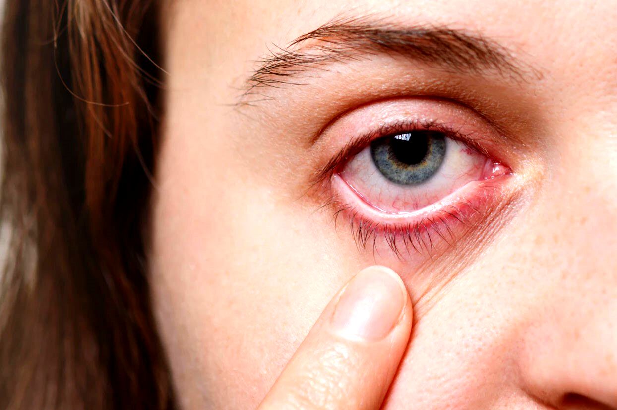 بلاهایی که آلودگی هوا بر سر چشم‌ها می‌آورد 