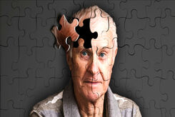 درمان آلزایمر با استفاده از ترکیبات ضد پیری