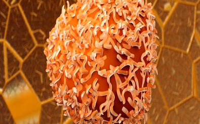 کیت نانویی تشخیص خون مخفی برای پایش سرطان روده